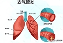 牙齿种植